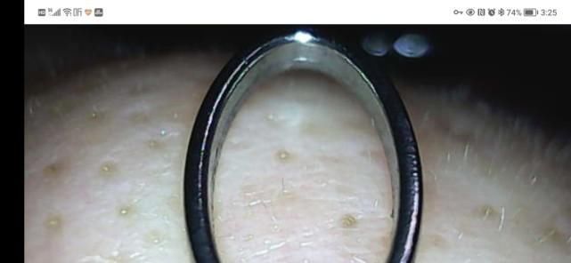 青春|洁净看得见,让青春轻松战“痘”: 媄拾智能可视毛孔清洁仪