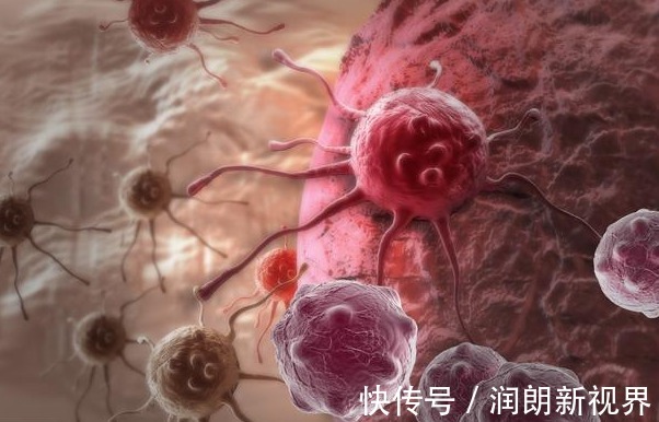 甲状腺|肺癌早期不疼不痒，身体2处持续瘙痒，说明肺受损，是时候养肺了