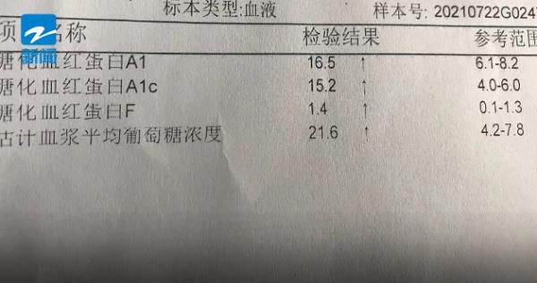 小林|浙江一15岁男孩右眼接近失明，只因为常喝…很多人都喜欢！