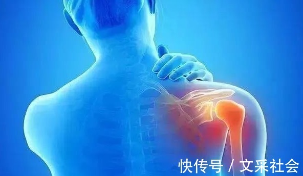 颈椎病|秘方来了!一碗老陈醋,赶走头晕手麻,和颈椎病、肩周炎说拜拜