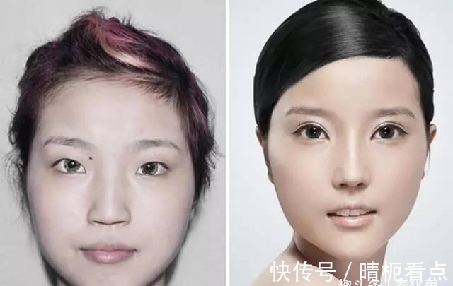 美白|实拍:10张女孩整容前后的对比照,这真就是换了一张脸