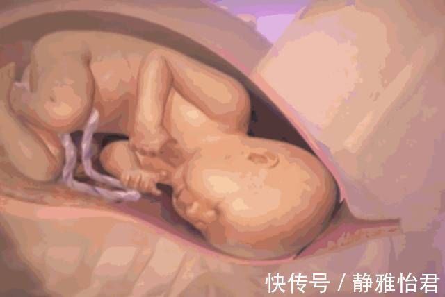 苦胆|同样是怀孕,为啥有人吐出苦胆,有人却从没吐过?原因和胎位有关