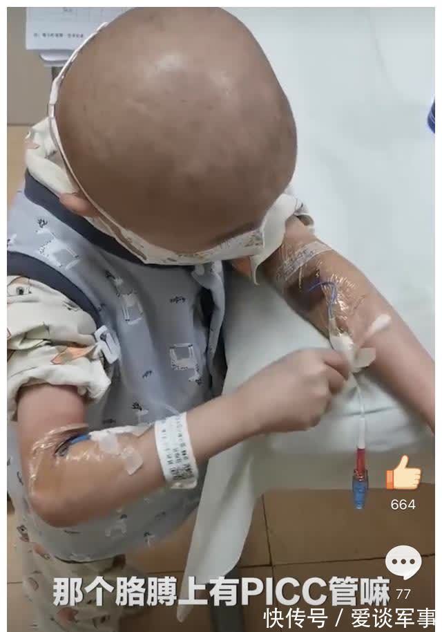 消毒|7岁男童骨髓移植后自己用棉签消毒，抽血时从来不哭，想快点上学