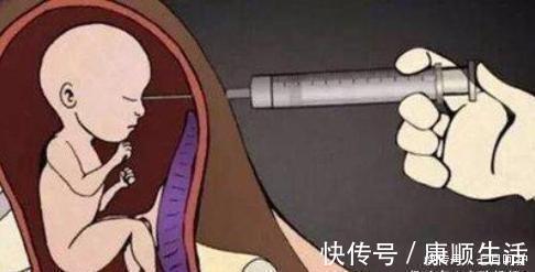 引产|孕妈做“引产”手术，腹中的胎儿会有感觉么看完忍不住心疼