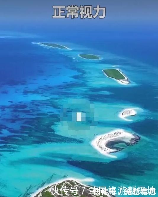 重影|近视的世界是怎样的孩子高度近视,与这两个习惯有很大关系