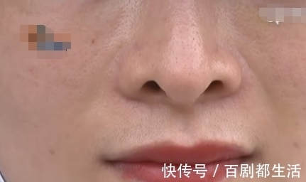 罗女士 女子花9万做整容,术后工作感情都受到影响