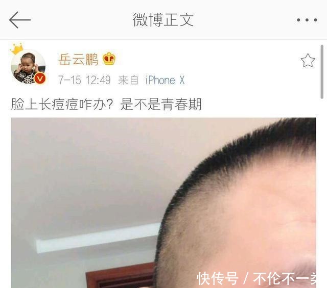 痘痘|刚把脸打湿就用洗面奶难怪痘痘黑头总是找上你!