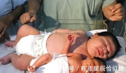 孩子|准妈妈总感觉肚里怀的不是孩子,孩子出生后,全家人都惊呆了!