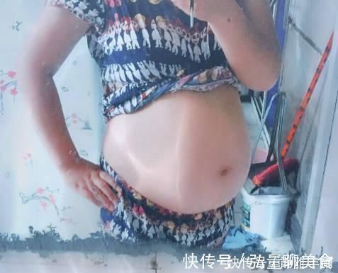 胎停育|孕期人机不离身,准妈妈对辐射不以为然,胚胎被诊断畸形