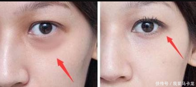 眼霜是早晚用还是每天一次？很多女人弄错，怪不得眼袋越来越大
