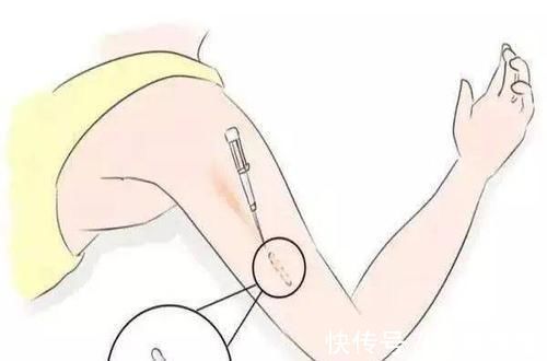 女人|女人避孕的方式有很多种,除了上环,还有哪些科学的避孕方法呢?