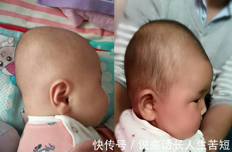 脊柱|4个错误做法,可能让宝宝骨骼“发育畸形”,很多人被蒙在鼓里