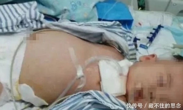 新生儿|出生才10天的宝宝会翻身,妈妈夸很聪明,奶奶看后急了:快送医院