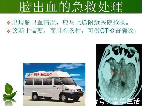 颅内压|脑出血就是脑溢血，医生提醒养成10个好习惯，脑血管才安全