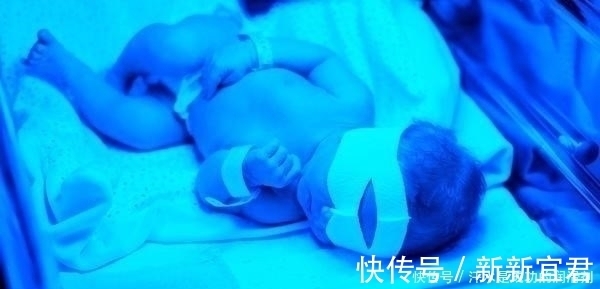 胆红素|不想宝宝出生后被黄疸“找上门”，孕期孕妈坚持“三不做”很关键