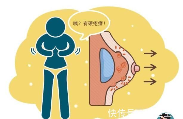 女性|女性乳腺癌发作前，身体会发出这6种异常信号，越早发现越好