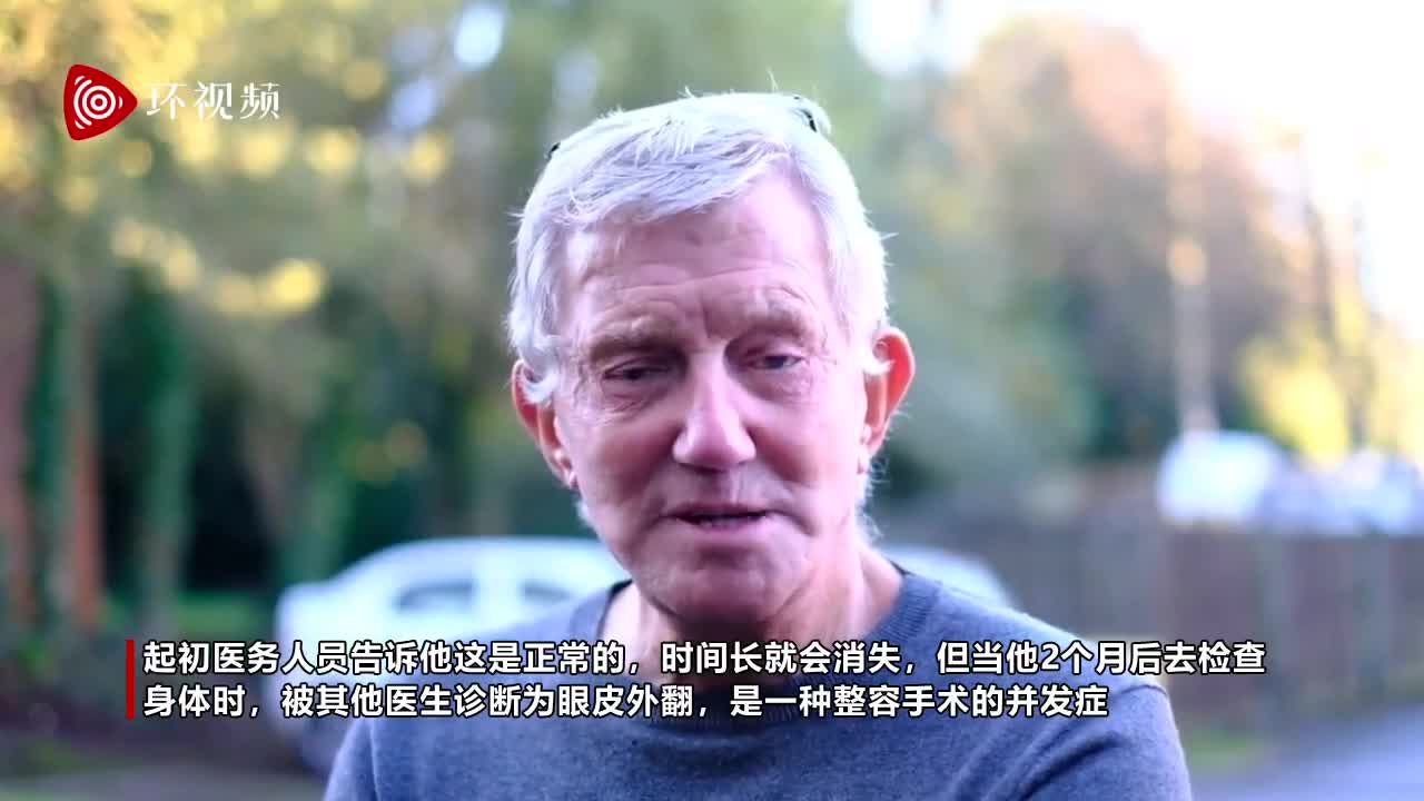 每日邮报|英国一79岁老人整容手术失败 导致左眼三年无法闭上