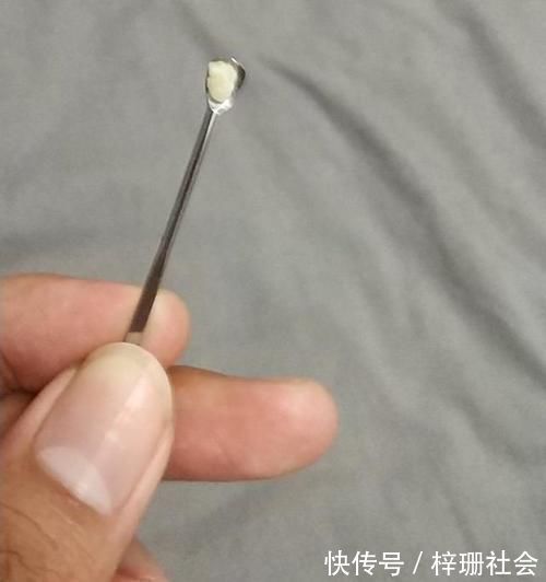 坏习惯|宝宝幼儿园遭人嫌弃,竟是因为口臭问题,取出这样东西后妈妈吐了