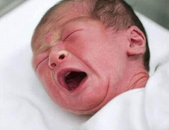 坏习惯|孩子出生后出现黄疸,多半是孕期时的坏习惯导致,要留心!