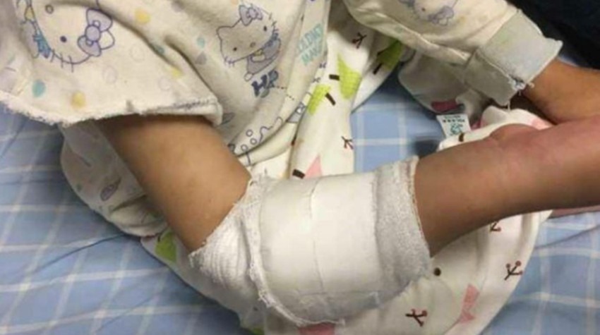 手臂疼|三岁女孩一直说手臂疼,送到医院检查后,医生说你们差点后悔一生