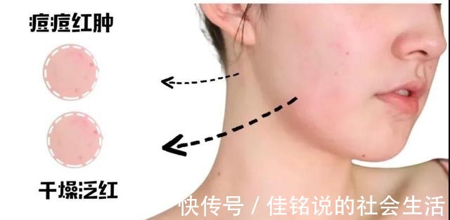 混搭 这些护肤品成分不能混搭,你知道吗!