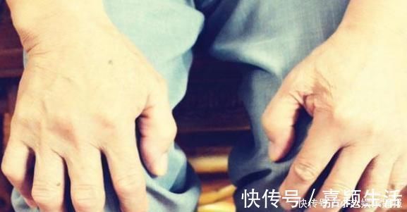 油腻食物|湿气重,伸伸舌头便知!想要湿气不“缠身”,牢记“3多3少”