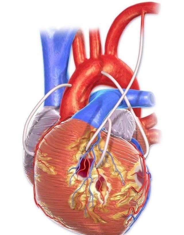 降压药|28岁护士老公，高血压、高血脂，不吃药血压血脂正常，怎么做到