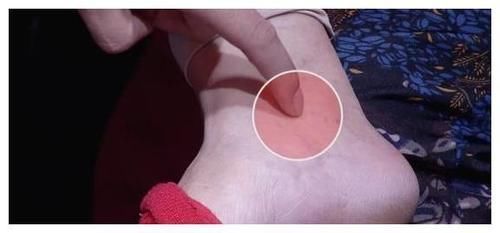 本草纲目|入睡难是肝郁结,睡不好是心火旺,常喝“一碗汤”,失眠自己好