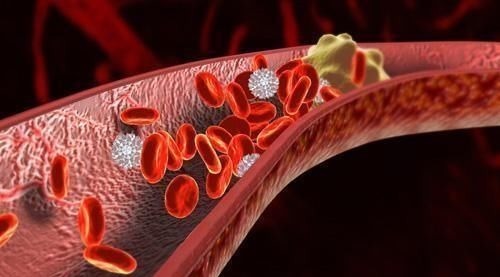 医生|56岁大姐天天吃素，却得高血脂，医生直言：再吃下去或离脑梗不远