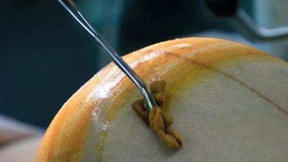 产检|孕妈妈生活习惯,会影响到胎儿的生活环境,羊水质量差和它们有关