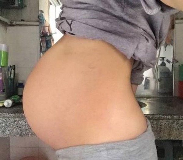 宝妈|宝妈剖腹产下龙凤胎,出产房时却只看到男宝,知道原因后悲痛欲绝