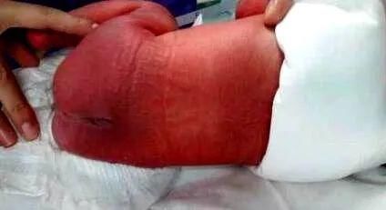 产妇|准妈妈不惜一切的去保护孩子，孩子出生后，产妇却当场被吓晕