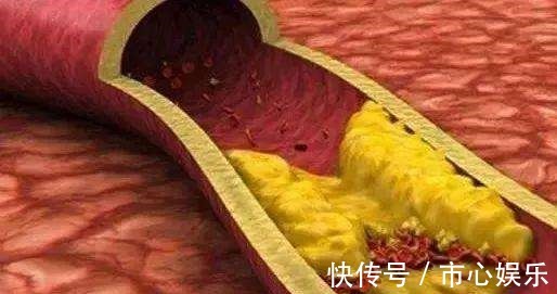 胆固醇含量|医生常吃5种食物的人,很难得高血脂,可是多数人都不爱吃