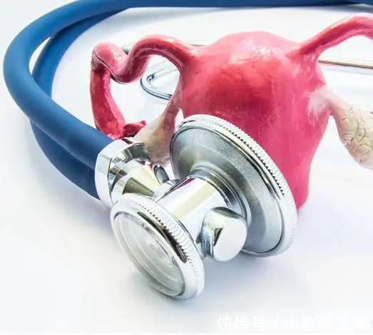 大伟|25岁姑娘卵巢衰老，医生两个恶习，让年轻人生不出孩子