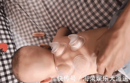 宝宝|“不着调”爸妈给孩子拔罐火了!看到宝宝专用“罐”后,网友笑喷