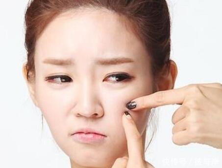 生理期|长痘留痘印怎么去是关键?做好这3点也许能帮到你