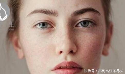 防晒|女人皮肤状态不好？专家提示：改掉这几个习惯，美白又淡斑