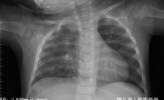 猴菇锌棘|退休中医6岁孙女从未去过医院,他坦言:孩子积食少,发育自然好