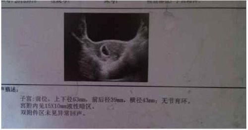 秘密|产检时,孕妇若发现3个“信号”,或许胎宝的“秘密”藏不住了