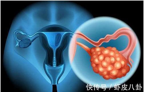 奶酪|绝经并非全是坏事,绝经后这些问题或会离你而去,偷着乐吧