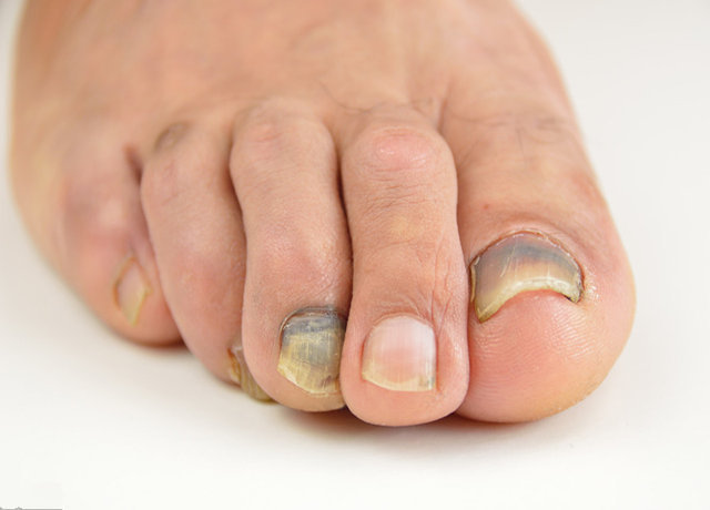 预防|癌症来降临前，大多伴有4种信号，教你3招，提前预防癌症