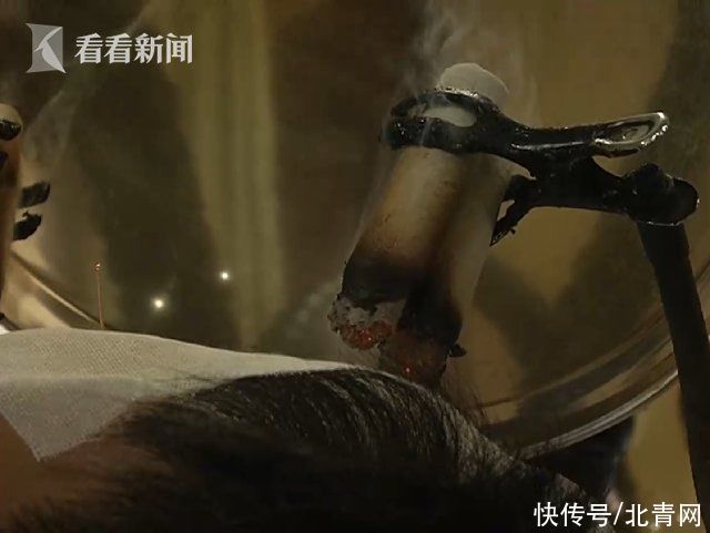 歪斜|空调、电扇轮番猛吹 小伙“眼歪嘴斜”进了医院