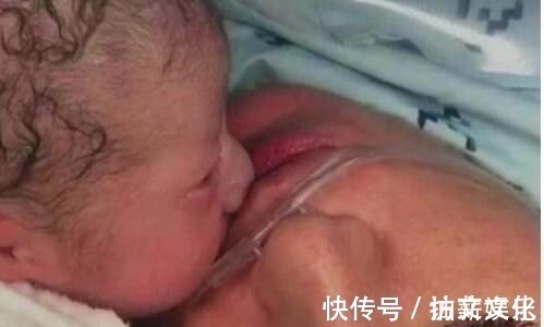 分泌物|宝宝出生时,有的睁开眼,有的闭上眼,哪种比较好医生说都好