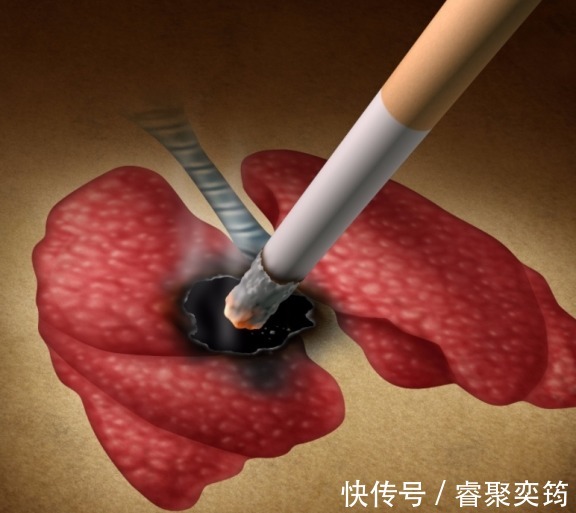 异常|头部出现3种异常，肺脏或已奄奄一息，发现其一，养肺不能再拖