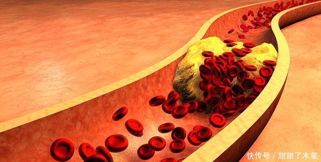 果中含|这1物堪称水果里的“全科医生”,每天一个,赶走疾病