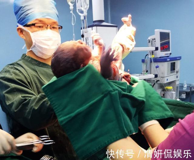 产科男医生|“生个孩子脸都丢光了”,宝妈回忆分娩脱裤子那会儿人都僵住了