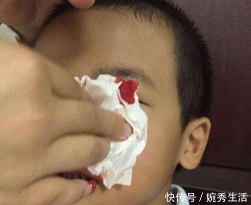 小常识|4岁男孩鼻血不止,送医院被告知“无法抢救”,只因宝妈这一举动