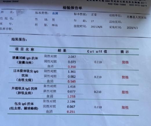 寄生虫|头皮发麻！男子吃这个东西当药引，结果身体里长满寄生虫！