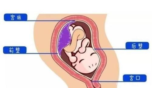 玄机|胎盘前壁是男孩,后壁是女孩?别说,胎盘的位置还真深藏“玄机” 美妈很帅