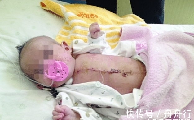 孩子|孕妇顺利生下男婴,产房外家人喜出望外,看到孩子后无人敢抱